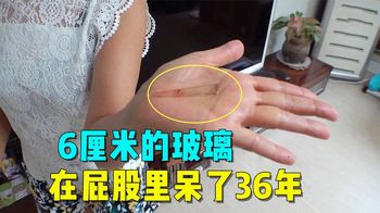 《赶尽杀绝》大妈脑袋里长了一块吸铁石，头上总会吸到曲别针之类的小东西