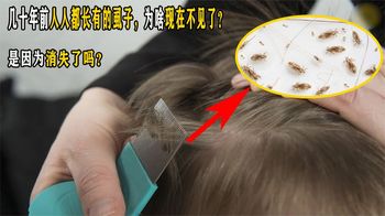 《纪录片》_几十年前人人都长有的虱子，为啥现在不见了？是因为消失了吗？